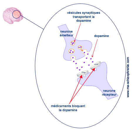 Cerveau schizophrénique : dysfonctionnements dopaminergiques et d'autres composés chimiques