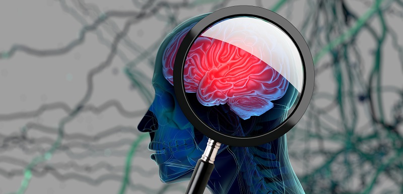 Un entraînement cérébral  pour traiter la schizophrénie sévère ?